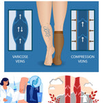 Before and after comparison graphic for varicose veins, showing a leg with twisted varicose veins on the left and a leg with compressed veins on the right, plus small medical illustration panels at the bottom.